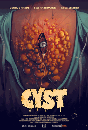 Cyst poster